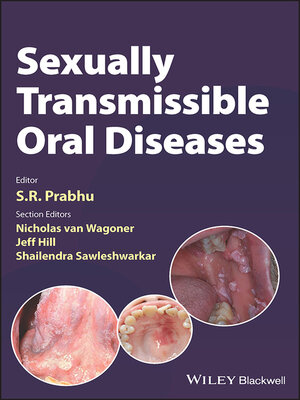 cover image of Sexually Transmissible Oral Diseases